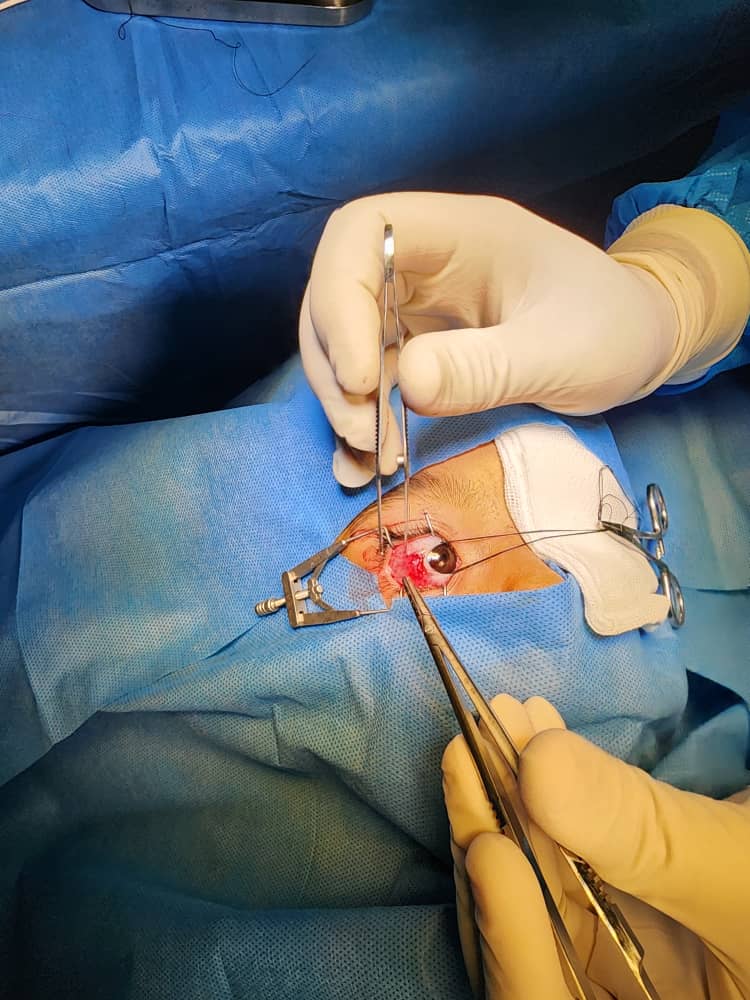 راه اندازی اتاق عمل چشم شروعی تازه است، تجهیز ادامه دارد…