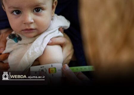 هشدار رئیس مرکز بهداشت استان نسبت به تداوم سوءتغذیه کودکان و پیامدهای آن در بزرگسالی